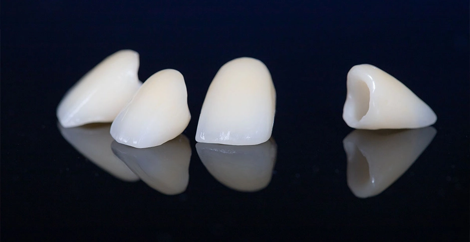 Upper Mt Gravatt Dentist - Blog - Dental crowns restore teeth and rejuvenate smiles - Zirconia crowns Zirconia crowns