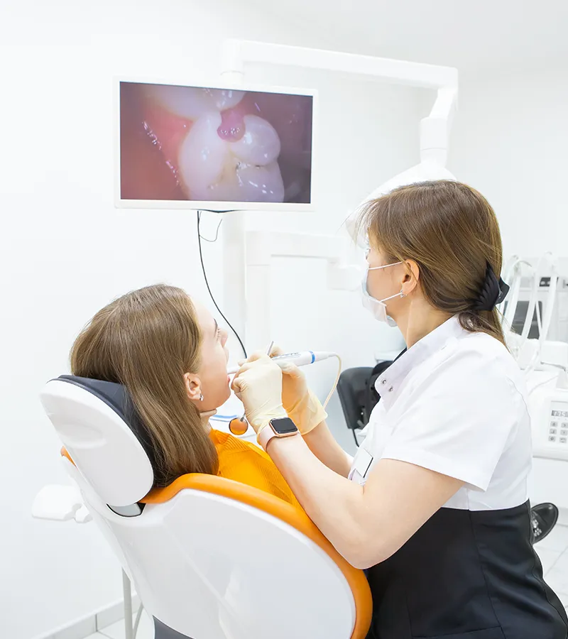 Intraoral cameras Intraoral cameras