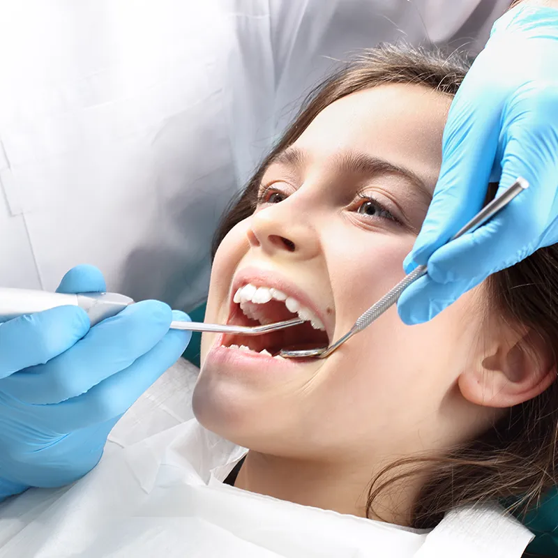 children dental sealants children dental sealants