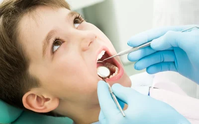 Dental sealants for little ones