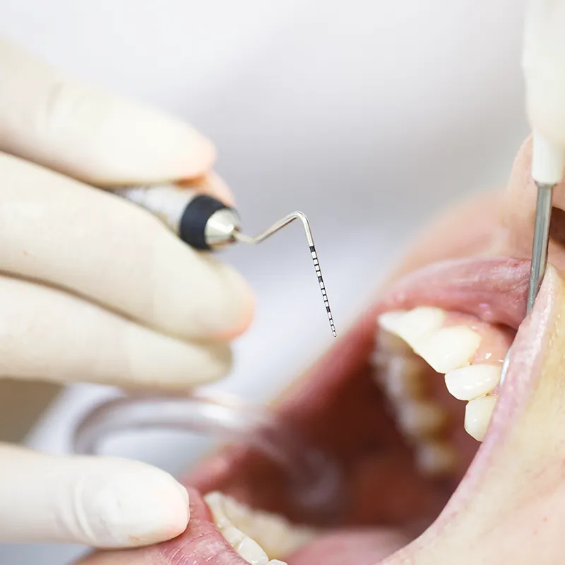 gum disease