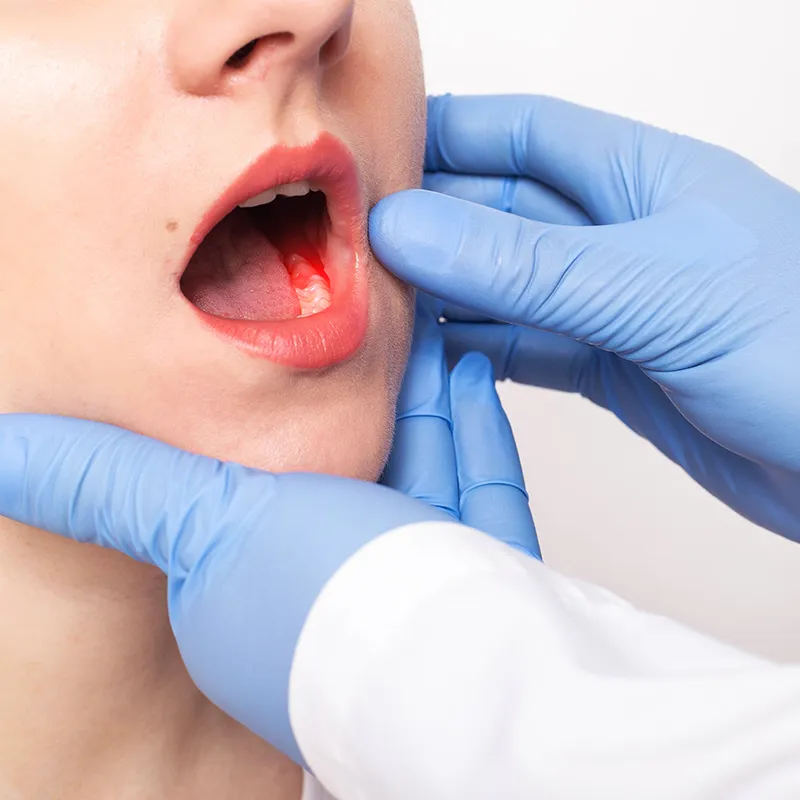 gum disease