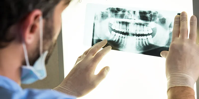 dental x-ray dental x-ray