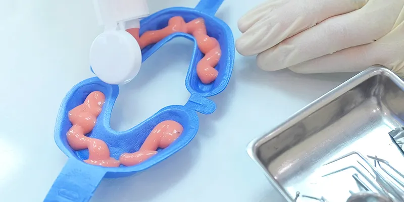 Dental fluoride treatments Dental fluoride treatments