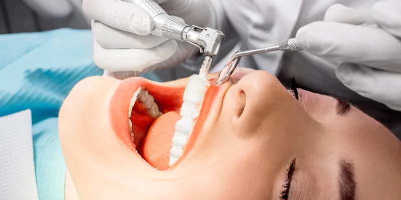 dental cleaning dental cleaning