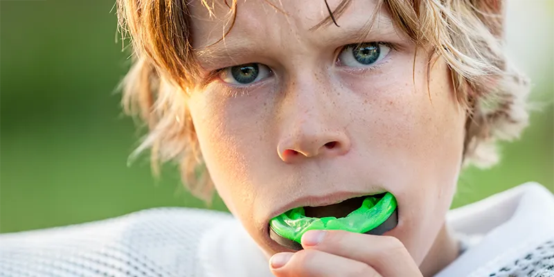 Mouthguard Mouthguard